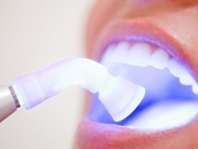Clareamento Dental Próximo à Av. dos Estados