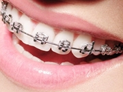 Ortodondista na ZL