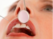 Fazer Cirurgia Dentária no Utinga