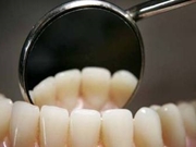 Tratamento Dentário