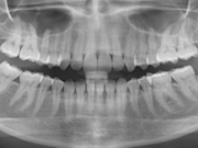 Raio X Dentário em SP